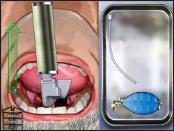 Krok 1 - Intubacja | Podstawy House M.D. - House M.D. - poradnik do gry
