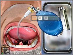 Krok 3 - Intubacja | Podstawy House M.D. - House M.D. - poradnik do gry