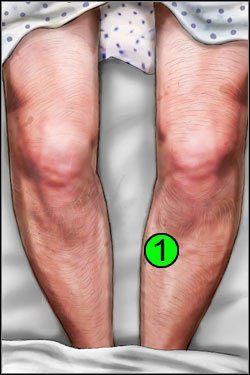 Symptomy: Nogi - Opis przejścia (1) | Globetrotting House M.D. - House M.D. - poradnik do gry