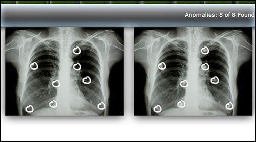 Twoim zadaniem jest zlokalizowanie 8 anomalii porównując dwa zdjęcia rentgenowskie - Opis przejścia (3) | Globetrotting House M.D. - House M.D. - poradnik do gry