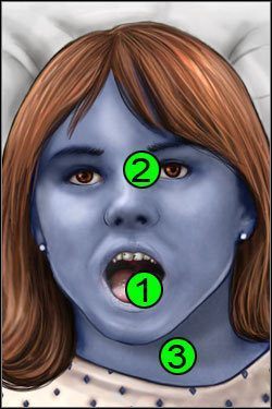 Symptomy: Głowa - Opis przejścia (1) | Blue Meanie | House M.D. - House M.D. - poradnik do gry