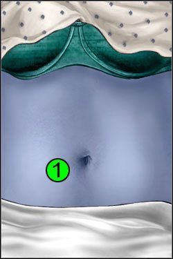 Symptomy: Brzuch - Opis przejścia (1) | Blue Meanie | House M.D. - House M.D. - poradnik do gry