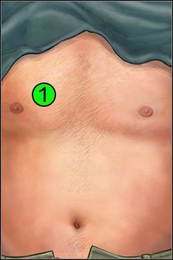 Symptomy: Klatka piersiowa - Opis przejścia (2) | Blue Meanie | House M.D. - House M.D. - poradnik do gry