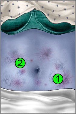 Symptomy: Brzuch - Opis przejścia (3) | Blue Meanie | House M.D. - House M.D. - poradnik do gry