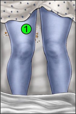 Symptomy: Nogi - Opis przejścia (3) | Blue Meanie | House M.D. - House M.D. - poradnik do gry