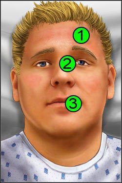 Symptomy: Głowa - Opis przejścia (1) | Skull & Bones | House M.D. - House M.D. - poradnik do gry