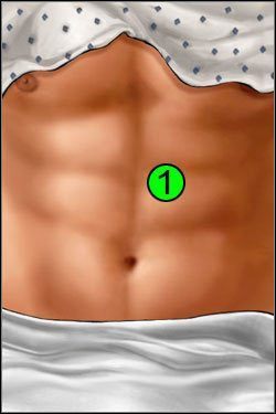 Symptomy: Brzuch - Opis przejścia (1) | Skull & Bones | House M.D. - House M.D. - poradnik do gry