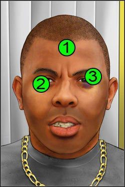 Symptomy: Głowa - Opis przejścia (4) | Skull & Bones | House M.D. - House M.D. - poradnik do gry