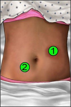 Symptomy: Brzuch - Opis przejścia (1) | Crashed | House M.D. - House M.D. - poradnik do gry