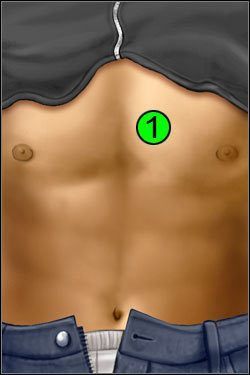 Symptomy: Klatka piersiowa - Opis przejścia (1) | Crashed | House M.D. - House M.D. - poradnik do gry