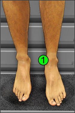 Symptomy: Nogi - Opis przejścia (1) | Crashed | House M.D. - House M.D. - poradnik do gry