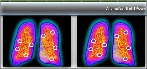 Twoim zadaniem jest zlokalizowanie 8 anomalii porównując dwa zdjęcia scyntygrafii - Opis przejścia (1) | Under The Big Top | House M.D. - House M.D. - poradnik do gry
