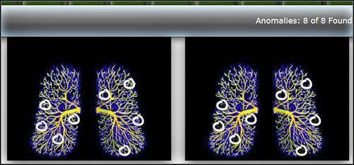 Twoim zadaniem jest zlokalizowanie 8 anomalii porównując dwa zdjęcia wentylacyjne płuc - Opis przejścia (1) | Under The Big Top | House M.D. - House M.D. - poradnik do gry