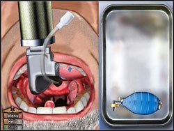 Wykonaj na pacjencie intubację - Opis przejścia (1) | Under The Big Top | House M.D. - House M.D. - poradnik do gry