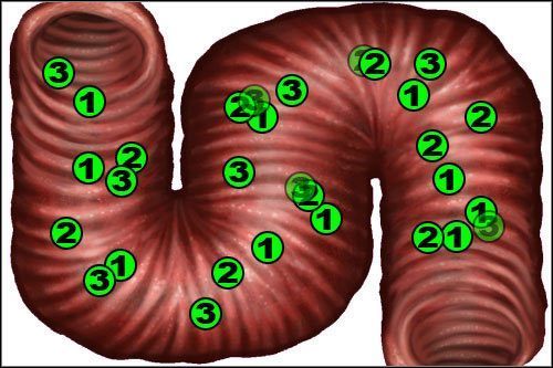 Dokonaj bronchoskopii na pacjencie - Opis przejścia (2) | Under The Big Top | House M.D. - House M.D. - poradnik do gry