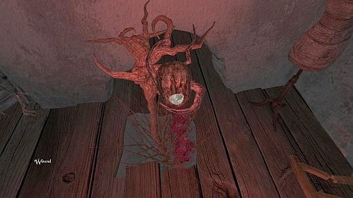 Udaj się w okolice szafy i spójrz w lewo - Przechodzimy na strych | Opis przejścia Anna - Anna - poradnik do gry