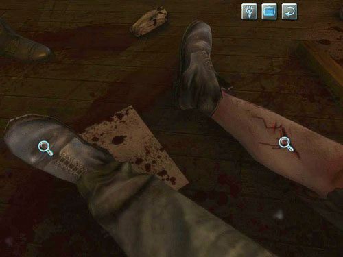 Obejrzyj także prawą nogę Kurtza, na której również ma paskudną ranę - Odwiedź Kurtza | Jatka w Whitechapel - Testament Sherlocka Holmesa - poradnik do gry