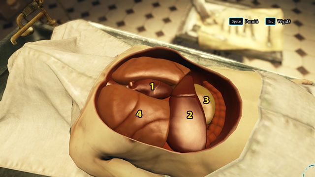 1 - serce, 2 - wątroba, 3 - żołądek, 4 - płuca. - Przeprowadź autopsję - Dramat w Kew Gardens - Sherlock Holmes: Zbrodnia i kara - poradnik do gry