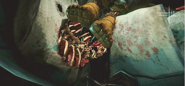 W MK X gracz ma dostęp do super ciosów X-Ray - Mortal Kombat X: Specjalne zagrania X-Ray - Mortal Kombat X - poradnik do gry