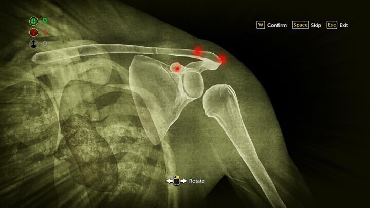Nastaw bark mężczyzny - wsuń kość, gdy punkty będą słabo podświetlone - Ratunek poszkodowanych w wypadku | Reakcja łańcuchowa | The Devils Daughter - Sherlock Holmes: The Devils Daughter - poradnik do gry