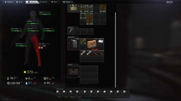 Obrażenia danej części ciała wpływają na Twojego bohatera. - Zdrowie i obrażenia w Escape from Tarkov - Escape from Tarkov - poradnik do gry