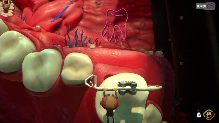 Dzięki drutowi, który jest wbity w ruszany przez was ząb, możecie wskoczyć na resztę szczęki - Psychonauts 2: Lobotos Labryinth - solucja, opis przejścia - Psychonauts 2 - poradnik do gry