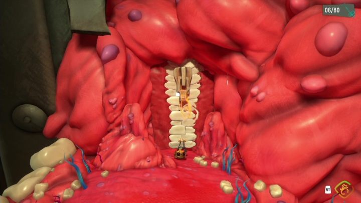 Zobaczycie zamek błyskawiczny, który znajduje się w części policzka - Psychonauts 2: Lobotos Labryinth - solucja, opis przejścia - Psychonauts 2 - poradnik do gry