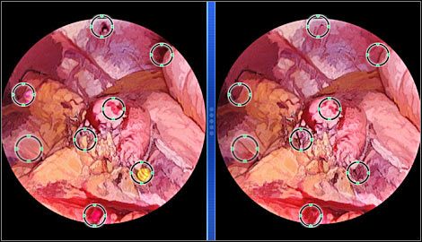 1 - Morgue #2 | Odcinek 3 | CSI NY - CSI: NY - poradnik do gry