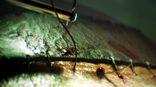 [2:00] Cofnijcie się sto lat przed wydarzenia z kultowych filmów, by poznać narodziny bezwzględnej filozofii bólu. SAW: Genesis zamienia powojenną traumę w bezwzględny, sieciowy horror 3 na 1