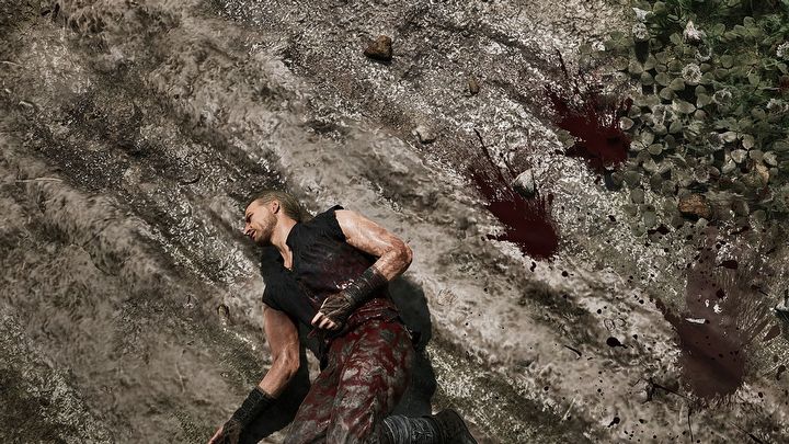 1 - Gothic Remake: Jak się leczyć? - Gothic Remake - poradnik do gry