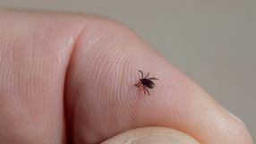 Prawie każdy telefon komórkowy ma wbudowany wykrywacz kleszczy w aparacie