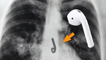 Amerykanin połknął słuchawkę Apple AirPods podczas snu