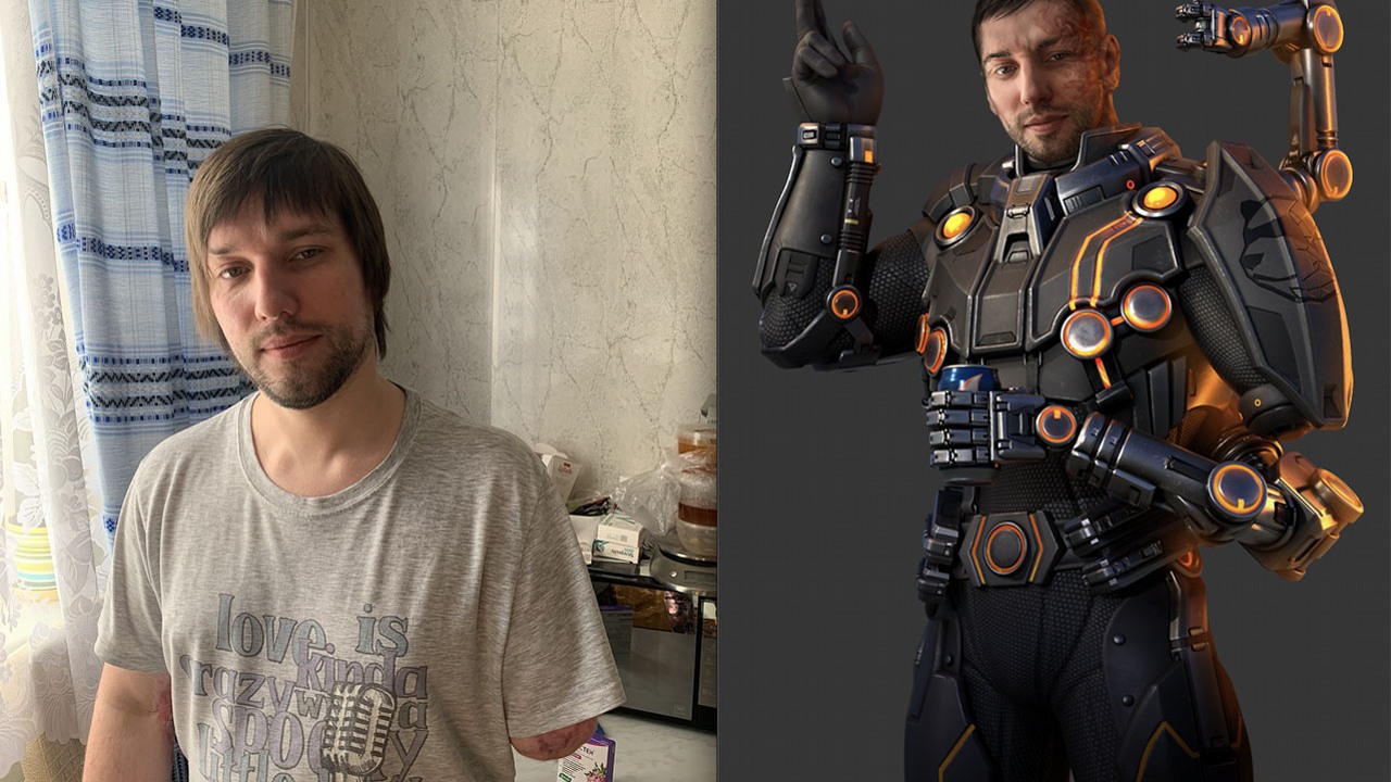 Uzyskał protezę dzięki DLC i pomocy kolegów - pozytywna historia z grą w tle.